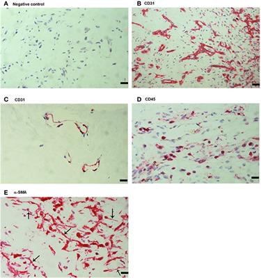 The Proinflammatory and Proangiogenic Macrophage Migration Inhibitory Factor Is a Potential Regulator in Proliferative Diabetic Retinopathy